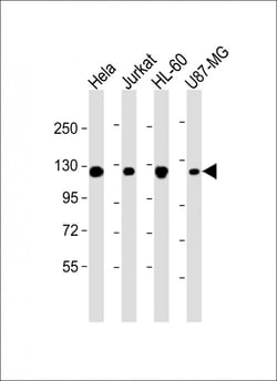 Invitrogen RNF20 Monoclonal Antibody (1594CT552.128.36) 200 &mu;L; Unconjugated:Antibodies,