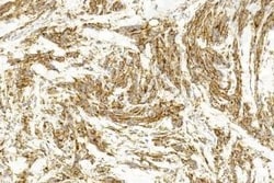 Invitrogen MiTF Monoclonal Antibody (1607CT834.207.47) 200 &mu;L; Unconjugated:Antibodies,