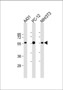 Invitrogen MiTF Monoclonal Antibody (1607CT834.207.47) 200 &mu;L; Unconjugated:Antibodies,