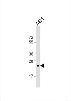 Invitrogen RAB5B Monoclonal Antibody (1615CT668.28.45) 200 &mu;L; Unconjugated:Antibodies,