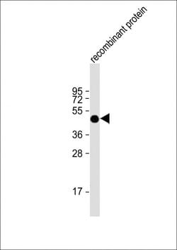 Invitrogen FAT1 Monoclonal Antibody (1634CT464.1.9) 200 &mu;L; Unconjugated:Antibodies,