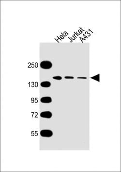 Invitrogen MYBBP1A Monoclonal Antibody (1702CT711.87.46) 200 &mu;L; Unconjugated:Antibodies,