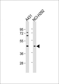 Invitrogen SERPINB3 Monoclonal Antibody (798CT5.2.2) 200 &mu;L; Unconjugated:Antibodies,