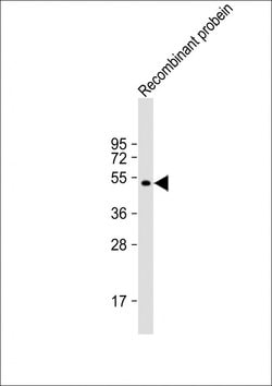 Invitrogen AKAP13 Monoclonal Antibody (1742CT411.87.24) 200 &mu;L; Unconjugated:Antibodies,
