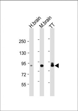 Invitrogen DCLK1 Monoclonal Antibody (1751CT665.1.72) 200 &mu;L | Buy Online | Invitrogen&trade; | Fisher Scientific