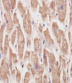 Invitrogen KANK1 Monoclonal Antibody (1773CT634.49.61) 200 &mu;L; Unconjugated:Antibodies,