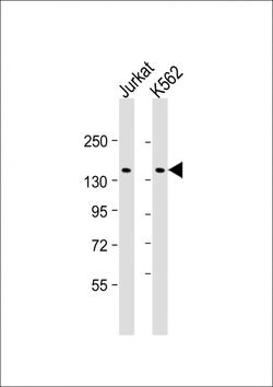 Invitrogen KANK1 Monoclonal Antibody (1773CT634.49.61) 200 &mu;L; Unconjugated:Antibodies,