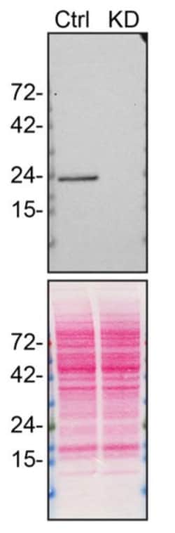 Invitrogen RAB14 Monoclonal Antibody (1779CT692.32.86) 200 &mu;L | Buy Online | Invitrogen&trade; | Fisher Scientific