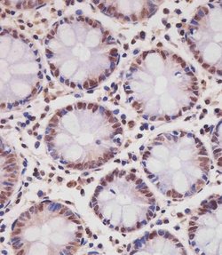 Invitrogen SMAD1 Monoclonal Antibody (1356CT119.18.55) 200 &mu;L; Unconjugated:Antibodies,