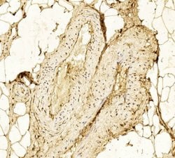 Invitrogen HK2 Monoclonal Antibody (1798CT748.15.25) 200 &mu;L; Unconjugated:Antibodies,