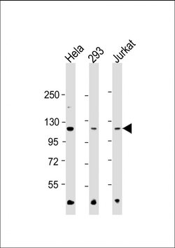 Invitrogen HK2 Monoclonal Antibody (1798CT748.15.25) 200 &mu;L; Unconjugated:Antibodies,