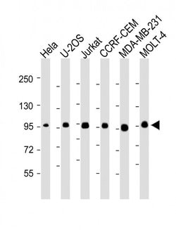 Invitrogen RANBP9 Monoclonal Antibody (1815CT202.22.8.37) 200 &mu;L; Unconjugated:Antibodies,