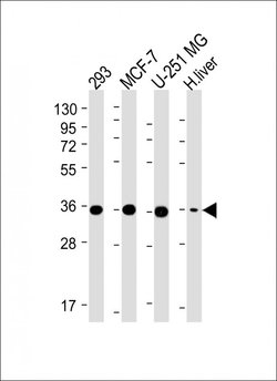 Invitrogen PDXK Monoclonal Antibody (1007CT2.1.1) 200 &mu;L; Unconjugated:Antibodies,