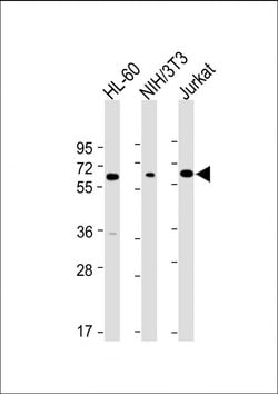 Invitrogen ME2 Monoclonal Antibody (970CT2.1.1.2) 200 &mu;L; Unconjugated:Antibodies,