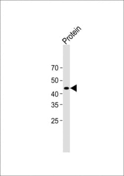 Invitrogen Strep Tag II Monoclonal Antibody (1810CT579.47.56.10) 200 &mu;L | Buy Online | Invitrogen&trade; | Fisher Scientific