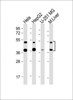 Invitrogen FDPS Monoclonal Antibody (1049CT13.1.4) 200 &mu;L; Unconjugated:Antibodies,
