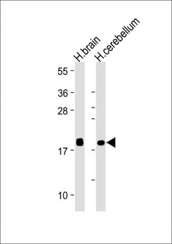 Invitrogen VSNL1 Monoclonal Antibody (1831CT148.68.34) 200 &mu;L; Unconjugated:Antibodies,