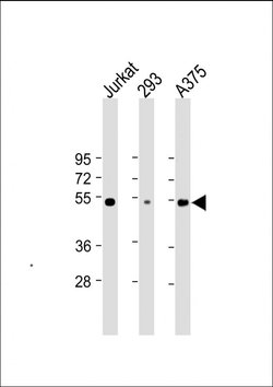 Invitrogen RBCK1 Monoclonal Antibody (1839CT718.19.54) 200 &mu;L; Unconjugated:Antibodies,