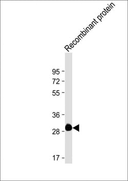 Invitrogen ROS1 Monoclonal Antibody (1843CT776.78.21) 200 &mu;L | Buy Online | Invitrogen&trade; | Fisher Scientific