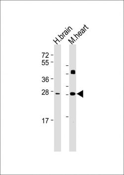 Invitrogen DKK2 Monoclonal Antibody (1833CT856.7.20) 200 &mu;L; Unconjugated:Antibodies,