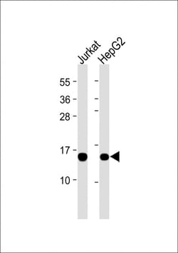 Invitrogen ROC1 Monoclonal Antibody (1859CT866.7.47) 200 &mu;L; Unconjugated:Antibodies,