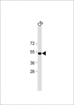 Invitrogen PSMC2 Monoclonal Antibody (1851CT193.4.40) 200 &mu;L | Buy Online | Invitrogen&trade; | Fisher Scientific