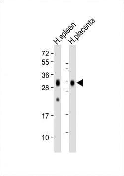 Invitrogen FOLR2 Monoclonal Antibody (1905CT501.41.76) 200 &mu;L; Unconjugated:Antibodies,