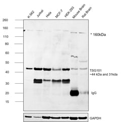 Invitrogen TSG101 Monoclonal Antibody (1883CT788.47.15.46) 200 &mu;L; Unconjugated:Antibodies,