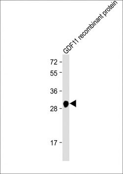 GDF11 Monoclonal Antibody (1956CT308.38.25):Antibodies, Monoclonal