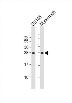 Invitrogen RAB27B Monoclonal Antibody (1596CT245.254.49) 200 &mu;L; Unconjugated:Antibodies,