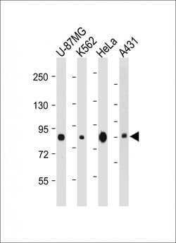 Invitrogen PLOD1 Monoclonal Antibody (2114CT109.4.71.73) 200 &mu;L; Unconjugated:Antibodies,