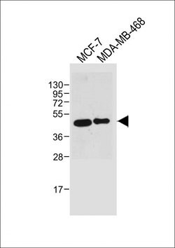 Invitrogen SULT2B1 Monoclonal Antibody (2142CT1553.26.63) 200 &mu;L; Unconjugated:Antibodies,