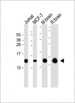 FKBP12 Monoclonal Antibody (2137CT1015.65.47):Antibodies, Monoclonal