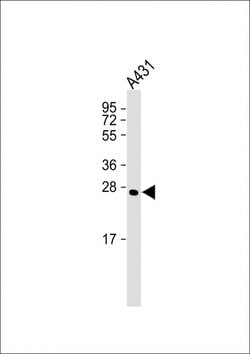Invitrogen Calpain S1 Monoclonal Antibody (2190CT339.12.2) 200 &mu;L; Unconjugated:Antibodies,