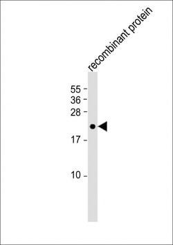 FGF4 Monoclonal Antibody (2188CT10.1.4):Antibodies, Monoclonal