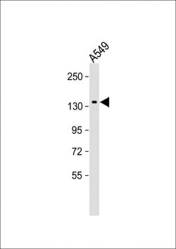 Invitrogen DAPK1 Monoclonal Antibody (2196CT239.5.2) 200 &mu;L | Buy Online | Invitrogen&trade; | Fisher Scientific