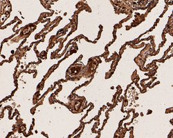 Invitrogen CEACAM6 Monoclonal Antibody (A1E2) 100 &mu;L; Unconjugated:Antibodies,