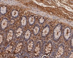 Invitrogen CEACAM6 Monoclonal Antibody (A1E2) 100 &mu;L; Unconjugated:Antibodies,