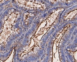 Invitrogen CEACAM6 Monoclonal Antibody (A1E2) 100 &mu;L; Unconjugated:Antibodies,