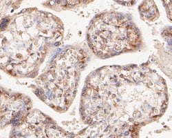 Invitrogen NFkB p52/p100 Monoclonal Antibody (16B2) 100 &mu;L; Unconjugated:Antibodies,