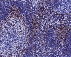 Invitrogen CD5 Recombinant Rabbit Monoclonal Antibody (JE25-41) 100 &mu;L | Buy Online | Invitrogen&trade; | Fisher Scientific