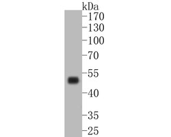 Invitrogen CD5 Recombinant Rabbit Monoclonal Antibody (JE25-41) 100 &mu;L | Buy Online | Invitrogen&trade; | Fisher Scientific