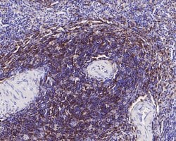 Invitrogen CD4 Recombinant Rabbit Monoclonal Antibody (JE56-36) 100 &mu;L;