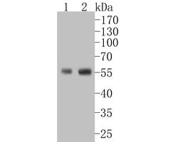 Invitrogen CD4 Recombinant Rabbit Monoclonal Antibody (JE56-36) 100 &mu;L;
