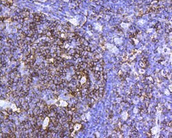 Invitrogen CD45 Recombinant Rabbit Monoclonal Antibody (JE03-05) 100 &mu;L;
