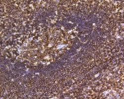 Invitrogen CD45 Recombinant Rabbit Monoclonal Antibody (JE03-05) 100 &mu;L;