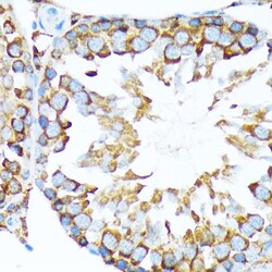 Invitrogen STIP1 Recombinant Rabbit Monoclonal Antibody (4S8L6) 100 &mu;L;