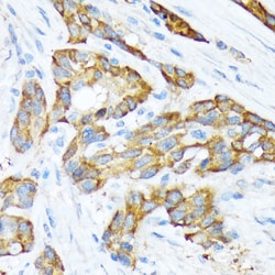 Invitrogen STIP1 Recombinant Rabbit Monoclonal Antibody (4S8L6) 100 &mu;L;