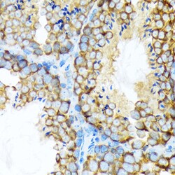 Invitrogen STIP1 Recombinant Rabbit Monoclonal Antibody (4S8L6) 100 &mu;L;