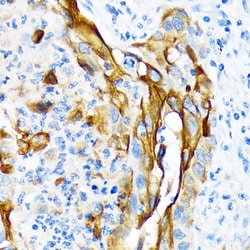 Invitrogen Cytokeratin 13 Recombinant Rabbit Monoclonal Antibody (5M6B10)